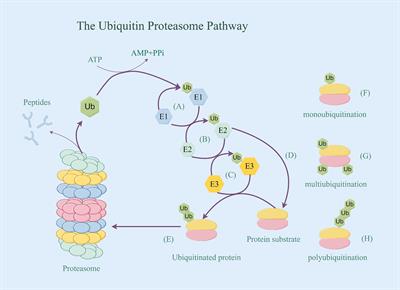 Involvement of ubiquitination in Alzheimer’s disease